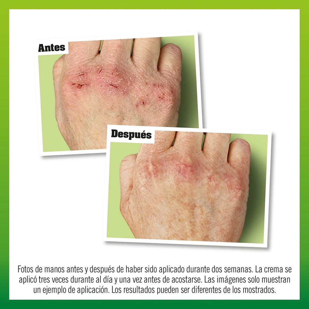 O'Keeffe'S Working Hands - Crema Para Manos Secas Y Agrietadas - Recupera Las Manos Dañadas - 96G